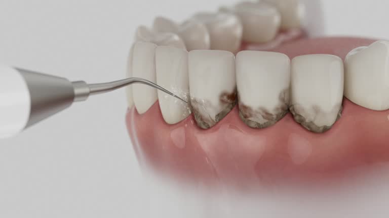 Reliable Dental Implants contractor in Maury, NC by Smile Center Dentistry